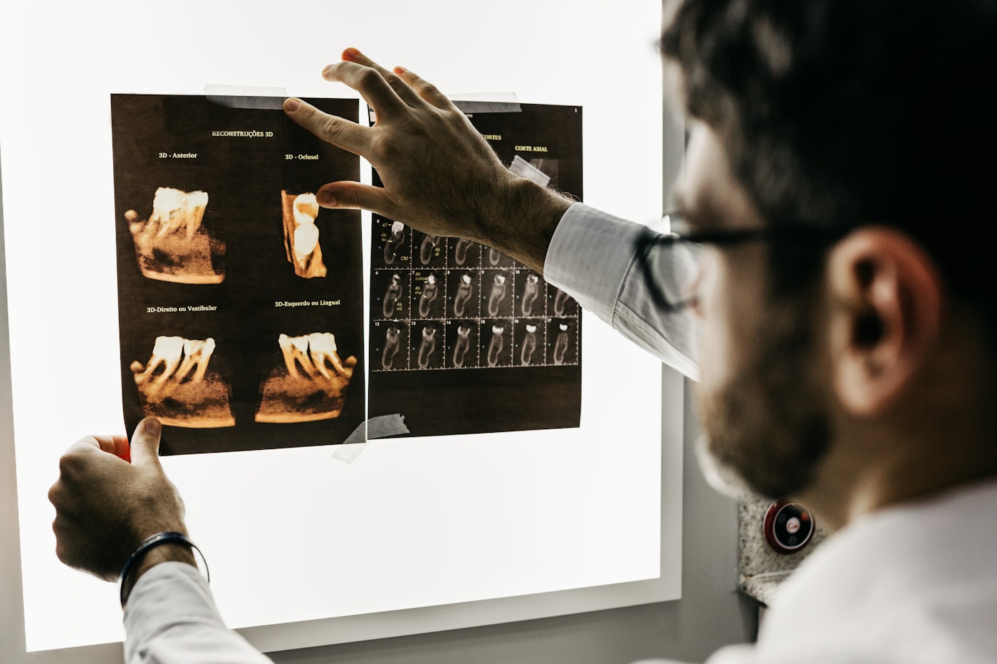 Digital dental diagnostics
